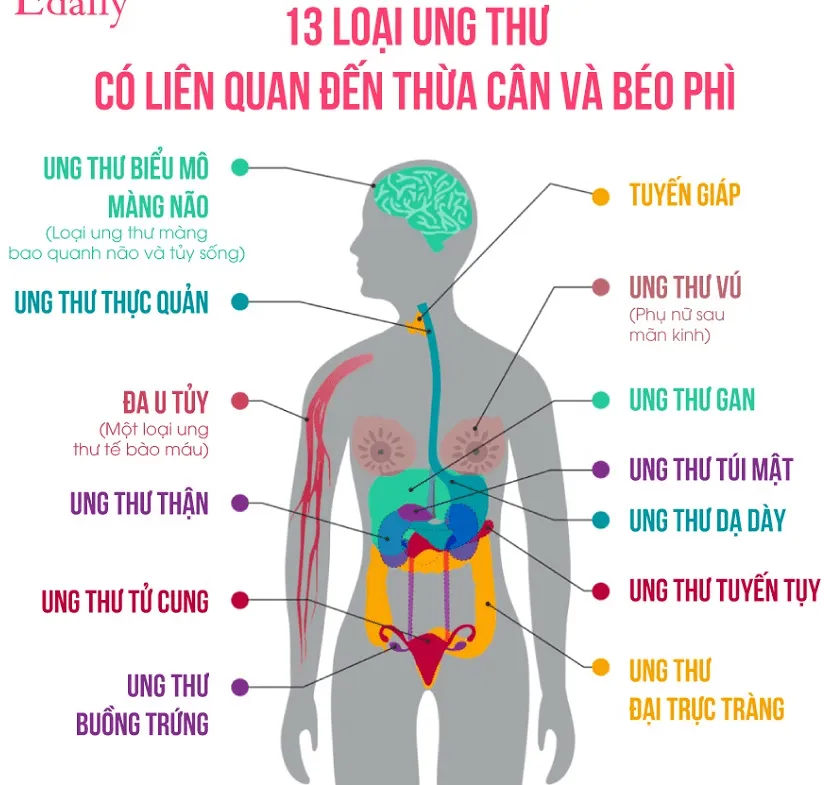 béo phì thường dẫn đến một số bệnh ung thư