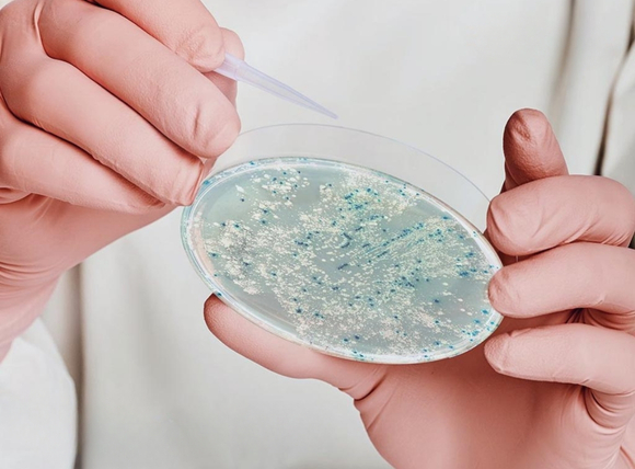 Phương pháp kiểm tra chính xác nước giếng nhiễm E.coli