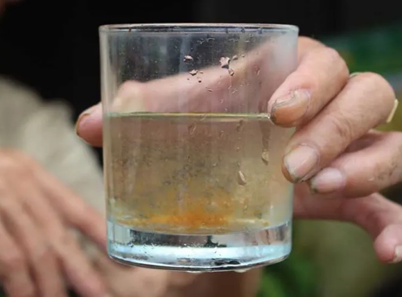 Cơ chế tích tụ sắt gây suy gan và suy thận