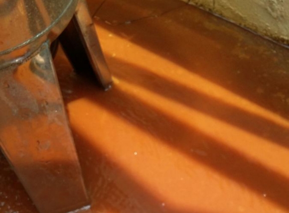 Thận làm việc quá tải khi phải lọc kim loại nặng