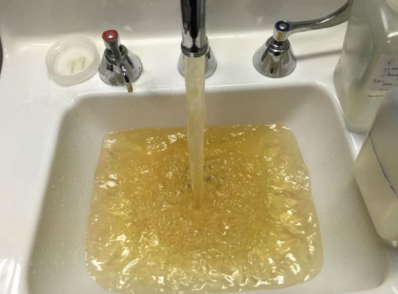 Nhóm người dễ bị tổn thương hơn khi dùng nước nhiễm sắt