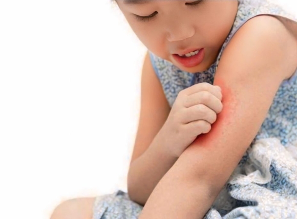 Nước bẩn khiến trẻ bị bệnh ngoài da và mắt