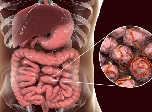 Nước bẩn sẽ gây nhiễm ký sinh trùng
