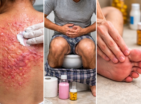 Kích ứng da, rối loạn tiêu hóa và các tác động ngoại vi khác
