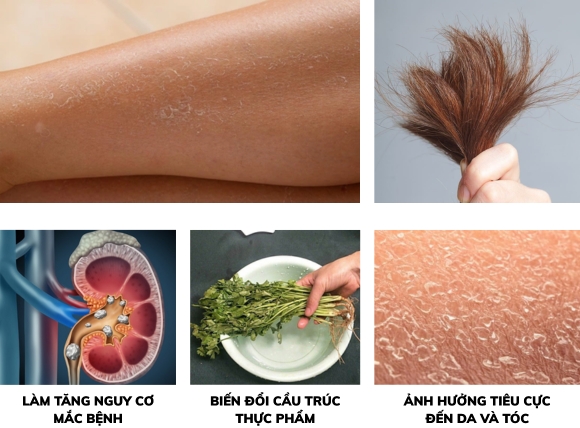 Tác hại của nước cứng đối với sức khỏe